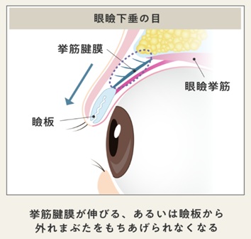 まぶたの構造
