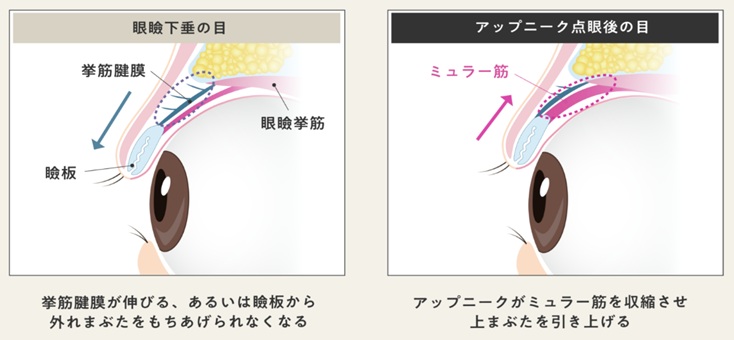 アップニーク画像2